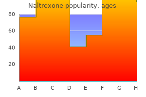 naltrexone 50 mg generic