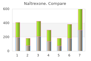 cheap naltrexone 50 mg mastercard