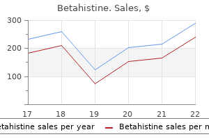discount betahistine 16 mg line